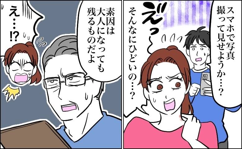 医師「大人になっても残るものだよ」首元に現れた赤い地図の正体。診察で知った事実【医師解説あり】