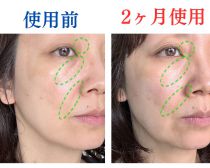使ってよかった！噂の美容液を2ケ月ぬった49歳、顔の老けサインに見られた変化