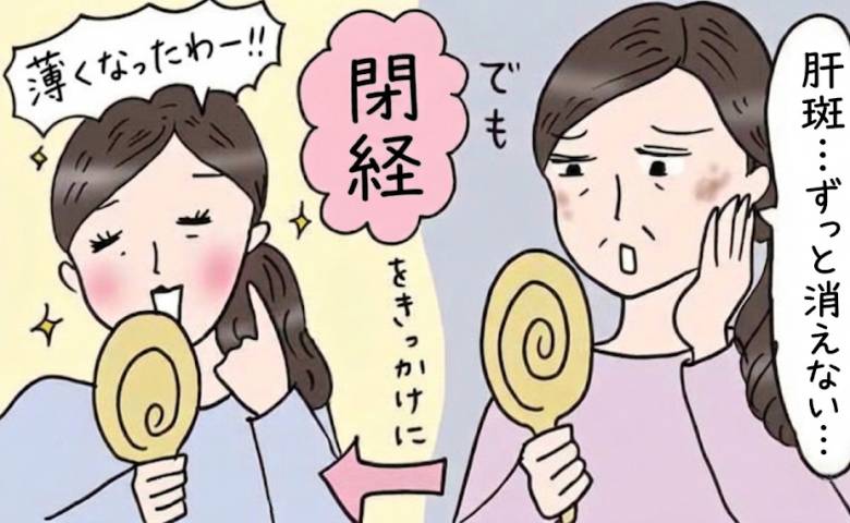 「頬が茶色い！」車の鏡に映った顔に困惑。放置したシミが53歳で変化した理由【医師解説あり】