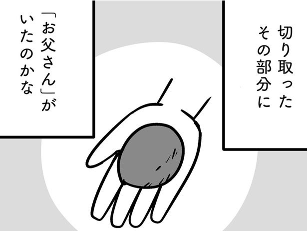 前頭葉の4分の1を切った父。手のひらに収まるサイズのそこに「父」がいた／家族を忘れた父親との23年間（15）