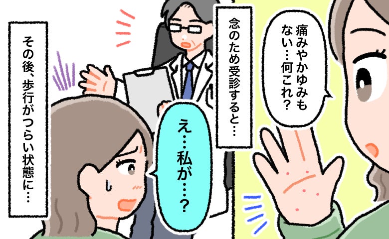 「痛みもかゆみもない」手足の発疹で下された病名に驚き。数日後に歩行がつらい状態に【医師解説あり】