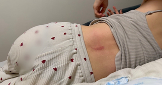  あいのり・桃、自宅階段から転落し背中負傷「バカすぎる…」 