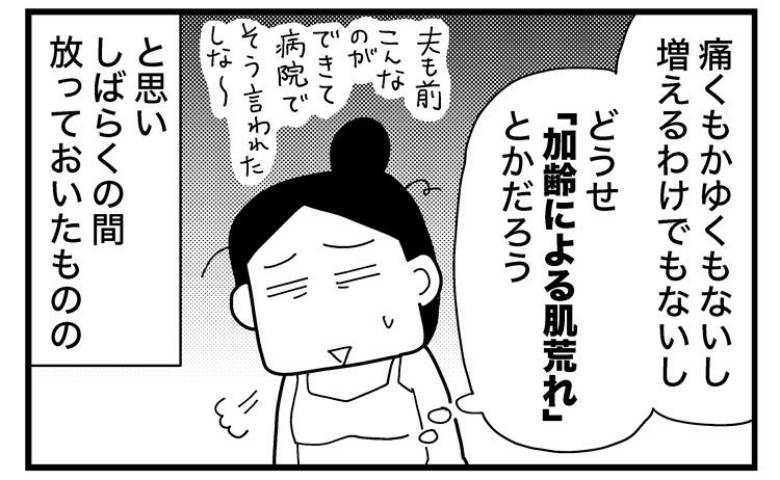 「加齢による肌荒れだと思ったら」放置厳禁な太もものポツポツの正体に冷や汗＜ときめけBBA塾＞