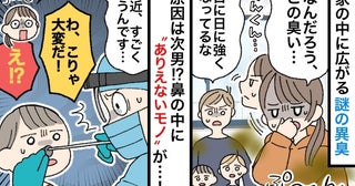 「息子がクサイんです」日に日に強くなる謎の異臭→原因は次男！鼻の中にありえないモノが見つかり！？