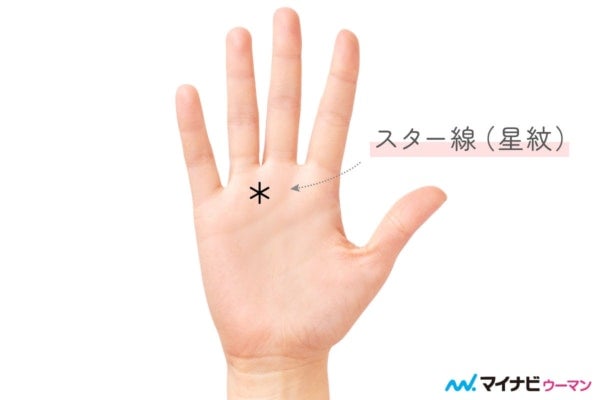 宝くじが当たるほどラッキー!?「スター線」を持つ人の2026年運勢とは【両手をチェック】