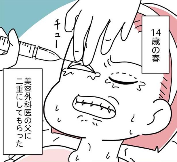 「すっげー、ブス」容姿への否定から始まった14歳の決断→整形費用は総額700万円…果てしない「理想」への渇望