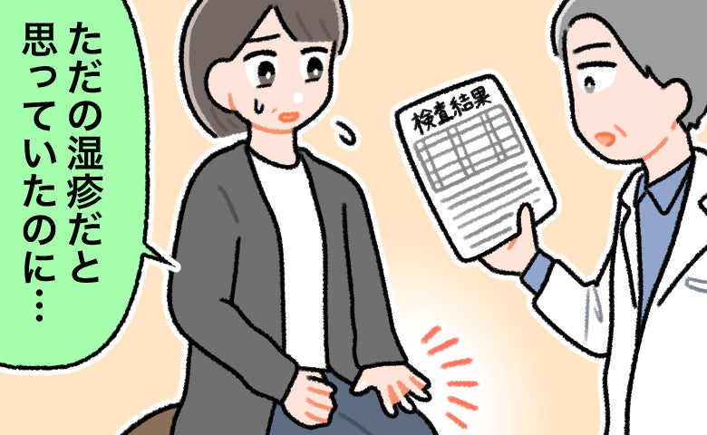 「ただの湿疹」が治らず顔まで腫れてきた。大学病院での精密検査で判明した病名とは【医師解説あり】