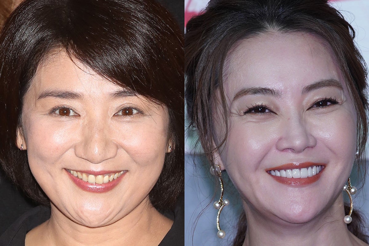 「看護師役が光った女優」ランキング！『ナースのお仕事』観月ありさ＆松下由樹コンビと競った演技派は？