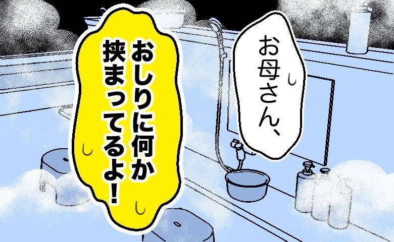 「お母さん、おしりに何か挟まってる！」温泉旅行で判明した母の異物の正体とは