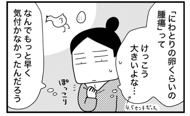 「にわとりの卵くらいの腫瘍ができています」大きいのに…私も家族も気付けなかったワケ＜喉のしこり＞