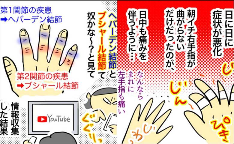 「手の痛みが悪化」関節リウマチは陰性。痛みの原因は一体…悩んだ結果＜手指のこわばり＞