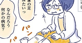 子宮筋腫を乗り越えたのに…。52歳、立っていられないほどの足のむくみに直面して／私の生理のしまい方（7）