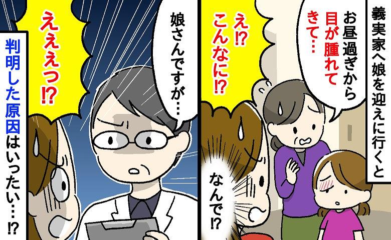 義実家に預けた娘の「目が半分しか開かない」…母は顔面蒼白！病院で検査の結果、医師に告げられたのは