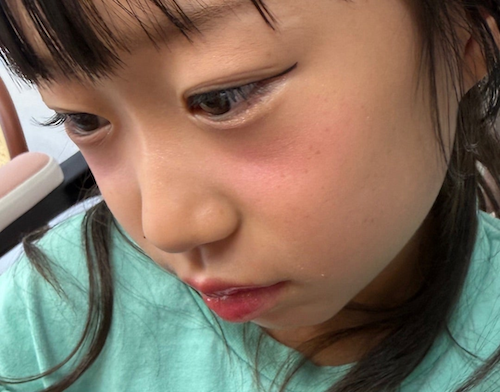  パンサー尾形の長女、理想の二重への強いこだわりに母驚き 