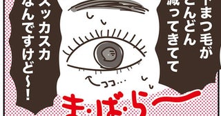 気付いたときには「スッカスカ」いつの間にか激減した「毛」問題がせつない件＜アラフィフの日常＞