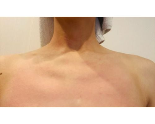  ココリコ遠藤の妻が兄弟ゲンカに疲弊、ストレスで蕁麻疹も… 
