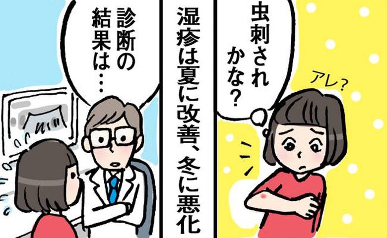 「虫刺されかな？」1cmの湿疹が3cm超に。夏は治まり、冬に悪化を繰り返したワケ【医師監修】