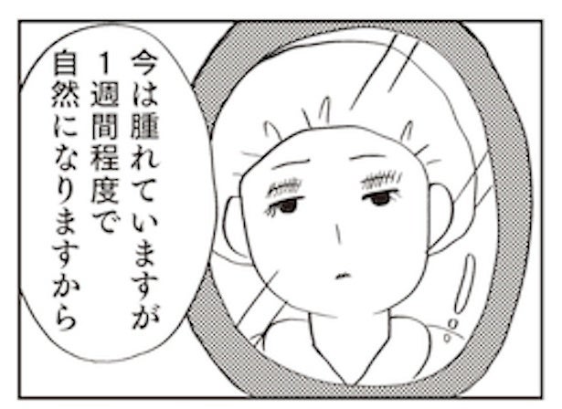 「一重はかわいそう」15歳で整形を強要した母。服を切り裂く支配から逃れるまで【作者に聞く】