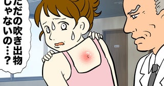 「ただの吹き出物かな」背中に大きなできもの。皮膚科で医師から告げられた言葉とは【医師解説あり】