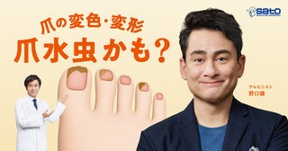 登山家・野口健さんが爪の健康の重要性を伝える、佐藤製薬“爪水虫疾患啓発TVCM”放映中