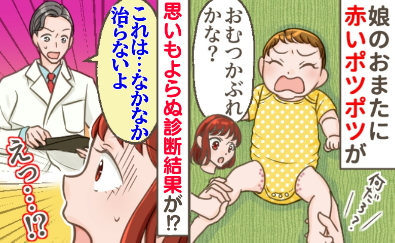 娘の下半身に赤いポツポツ…医師「治すのに1カ月はかかると思って」えっ？おむつかぶれじゃないの！？