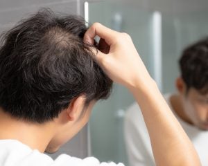 鏡を見るのがツラい…薄毛で「美容室が苦痛」になった中年男性の苦悩。プロが“恥じる必要がない”と断言する理由