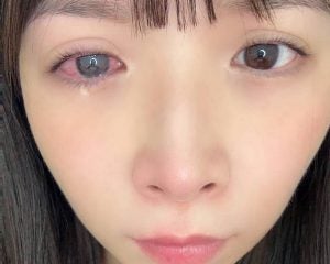 勤務先でグラドル時代を「人生の汚点」と言われ…「100万人に2〜3人」の病気に苦しむ30才女性が、それでも芸能活動を続けるワケ