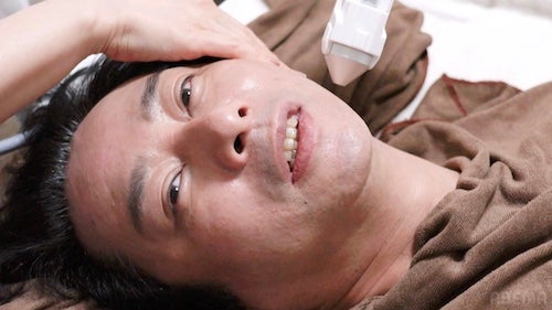  「もう１回だけ舞台に…」いしだ壱成が最新の再生美容施術に挑戦 
