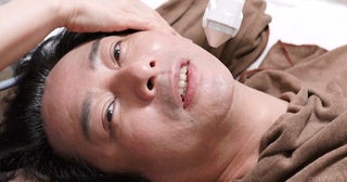  「もう１回だけ舞台に…」いしだ壱成が最新の再生美容施術に挑戦 