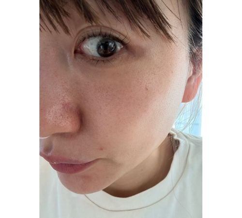  あいのり･桃「この感覚は初めて…」「すごすぎ韓国の美容医療…」 