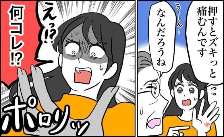 「何だろうね」医師も正体を見抜けなかった手のしこり。数年後、皮膚から現れた異物の正体【医師監修】