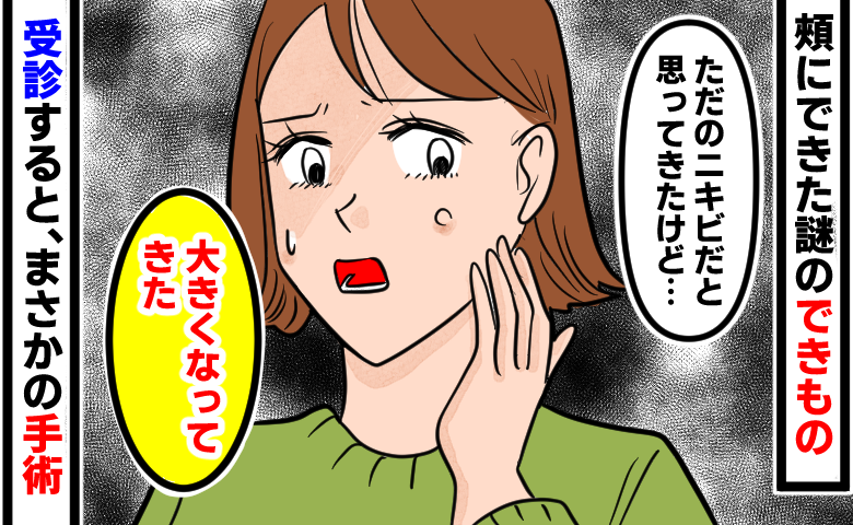 「ニキビだよね？」日に日に大きくなる頬のできものに不安。受診して手術を受けた結果【医師解説あり】