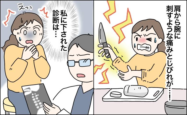 「肩から腕に刺すような痛みとしびれ」包丁やフライパンが持てず料理が困難に。私に下された診断は